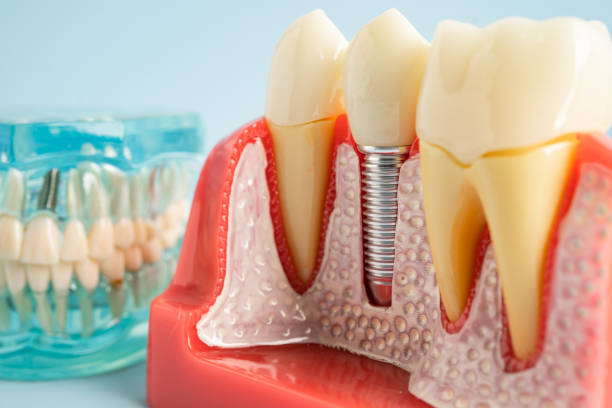 Best Root Canal Treatment  in Cecilia, LA